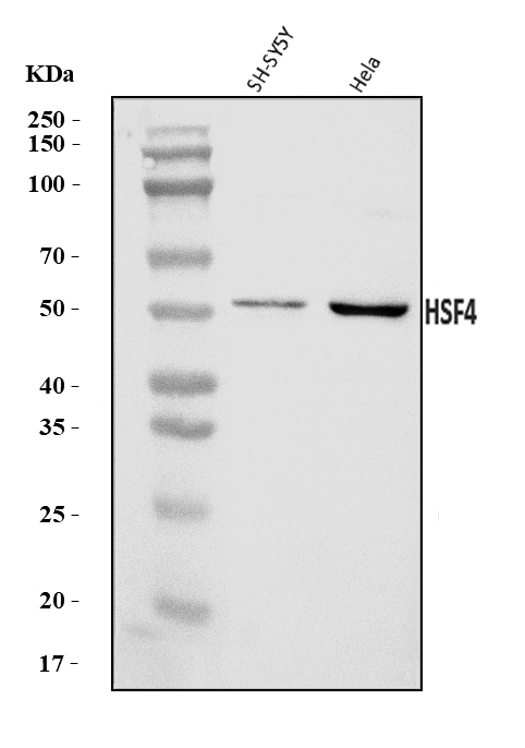  Western blot analysis of HSF4 using anti-HSF4 antibody (A04440)