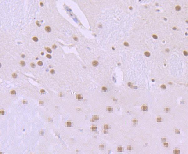 Immunohistochemical analysis of paraffin-embedded rat brain tissue using anti-ILF2 antibody