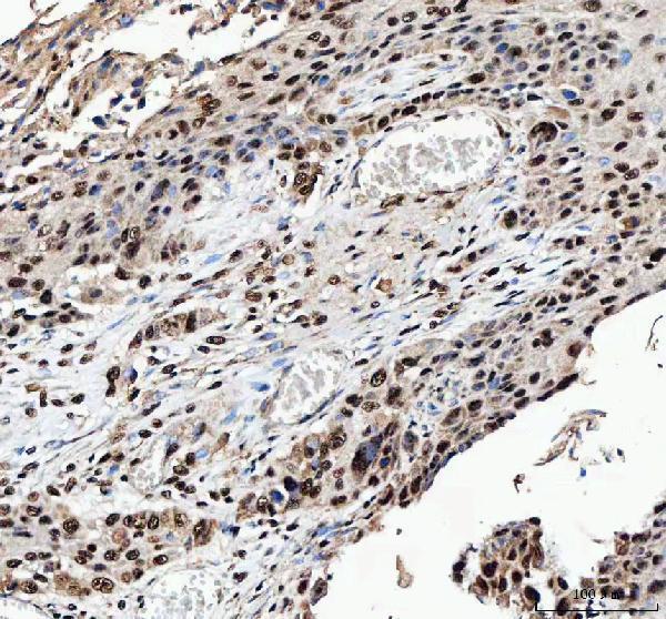a04443 2 ilf2 primary antibodies ihc testing 2