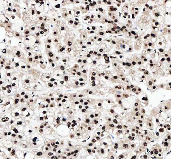 a04443 2 ilf2 primary antibodies ihc testing 3