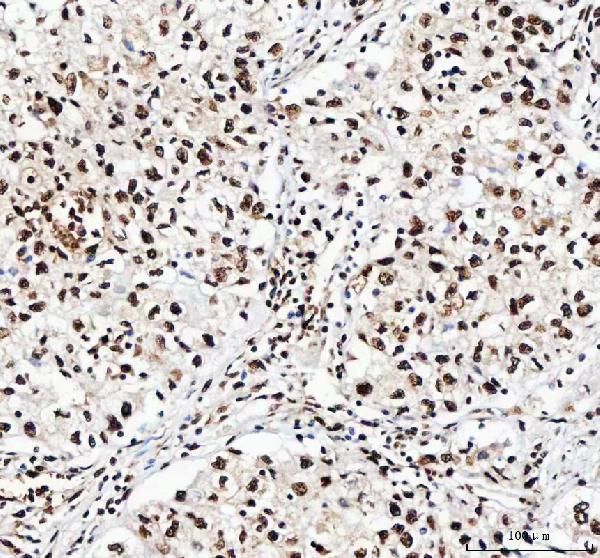 a04443 2 ilf2 primary antibodies ihc testing 4
