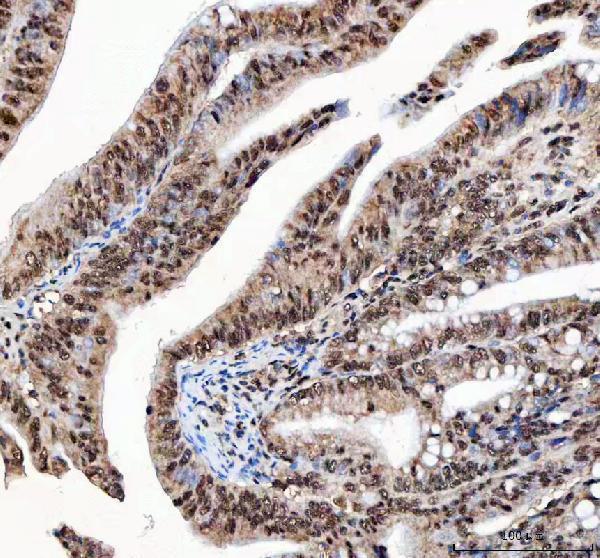 a04443 2 ilf2 primary antibodies ihc testing 5