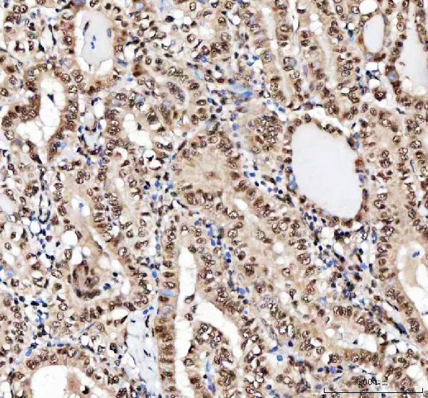 a04443 2 ilf2 primary antibodies ihc testing 6