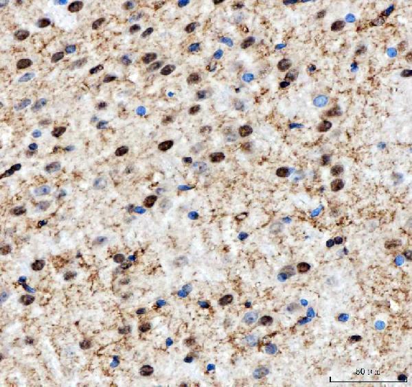 a04443 2 ilf2 primary antibodies ihc testing 7