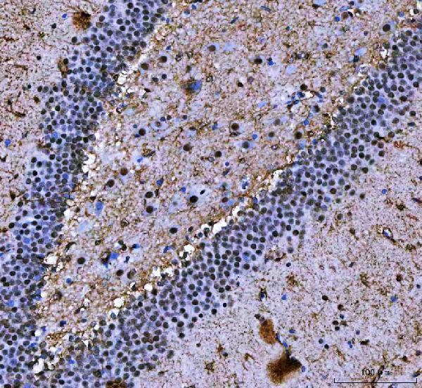 a04443 2 ilf2 primary antibodies ihc testing 8