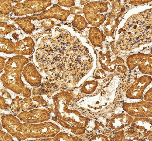 IHC analysis of SELENBP1 using anti-SELENBP1 antibody (A04444-3)