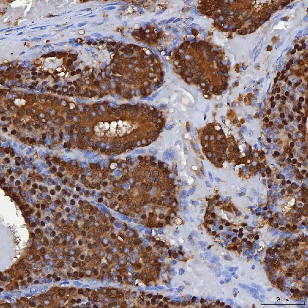 a04444 3 selenbp1 primary antibodies ihc testing 3