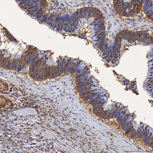 a04444 3 selenbp1 primary antibodies ihc testing 4