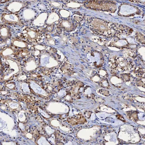 a04444 3 selenbp1 primary antibodies ihc testing 5