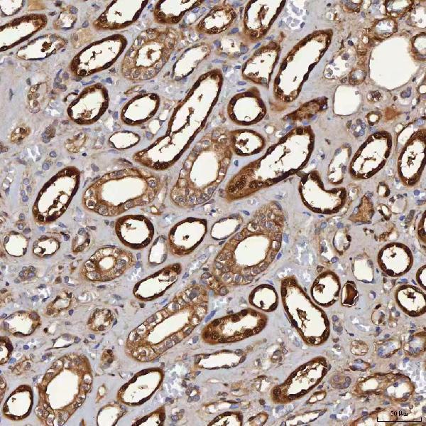 a04444 3 selenbp1 primary antibodies ihc testing 6
