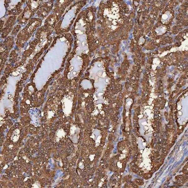 a04444 3 selenbp1 primary antibodies ihc testing 7