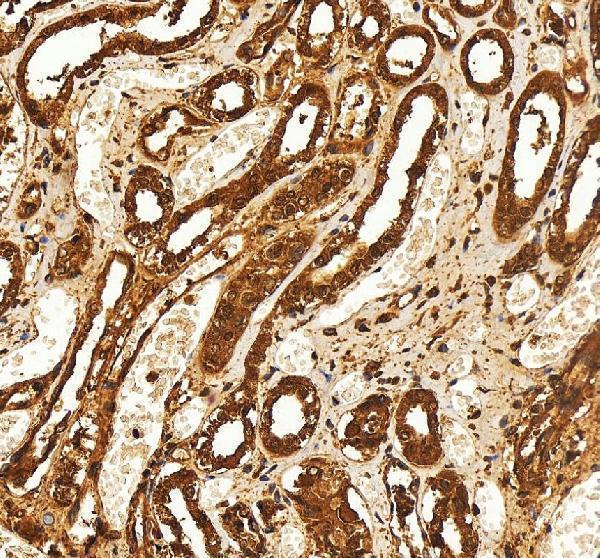 IHC analysis of SELENBP1 using anti-SELENBP1 antibody (A04444-3)