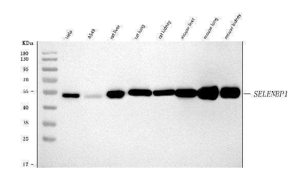  Western blot analysis of SBP/SELENBP1 using anti-SBP/SELENBP1 antibody (A04444-3)