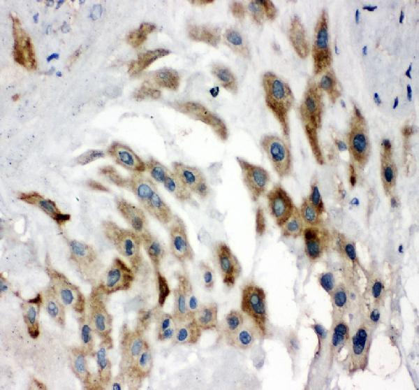 a04448 1 noggin primary antibodies ihc testing 2