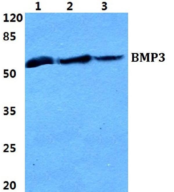Western blot (WB) analysis of BMP3 polyclonal antibody at 1:500 dilution
Lane1:HEK293T cell lysate
Lane2:PC12 cell lysate
Lane3:H9C2 cell lysate