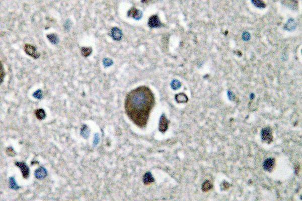 a04451 1 akap1 primary antiboties ihc testing 2