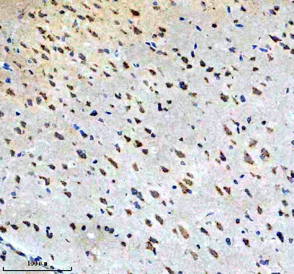 a04453 3 fut8 primary antibodies ihc testing 3