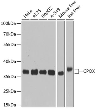 Western blot analysis of extracts of various cell lines, using CPOX antibody  at 1:1000 dilution