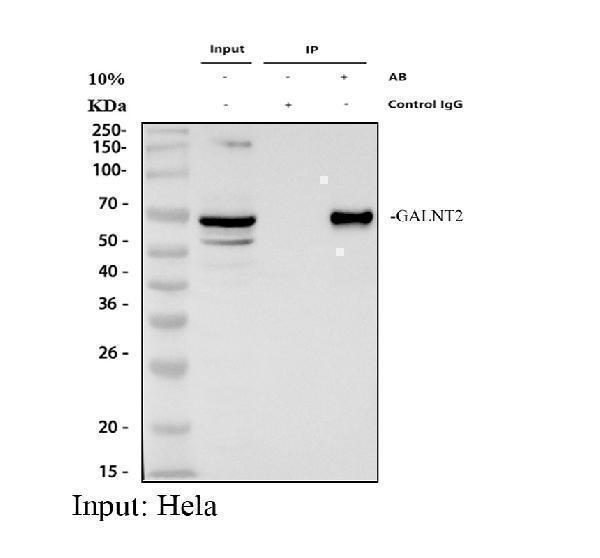 Immunoprecipitating (IP) GALNT2 in Hela whole cell lysate