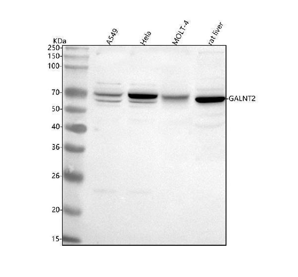  Western blot analysis of GALNT2 using anti-GALNT2 antibody (A04458-1)