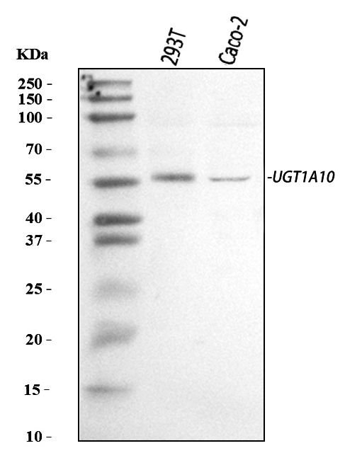  Western blot analysis of UGT1A10 using anti-UGT1A10 antibody (A04459)