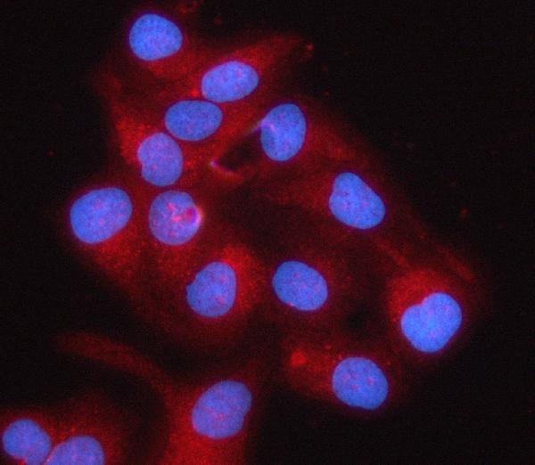 a04460 2 rps5 primary antibodies if testing 6