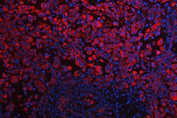 a04460 2 rps5 primary antibodies if testing 7