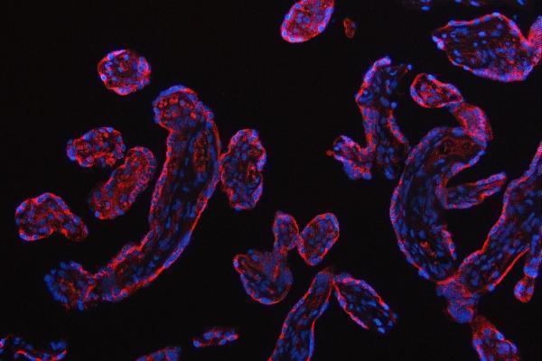 a04460 2 rps5 primary antibodies if testing 8