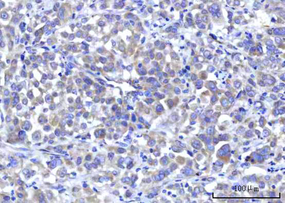  IHC analysis of RPS5 using anti-RPS5 antibody (A04460-2)