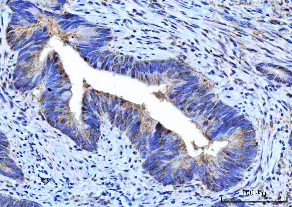 a04460 2 rps5 primary antibodies ihc testing 4