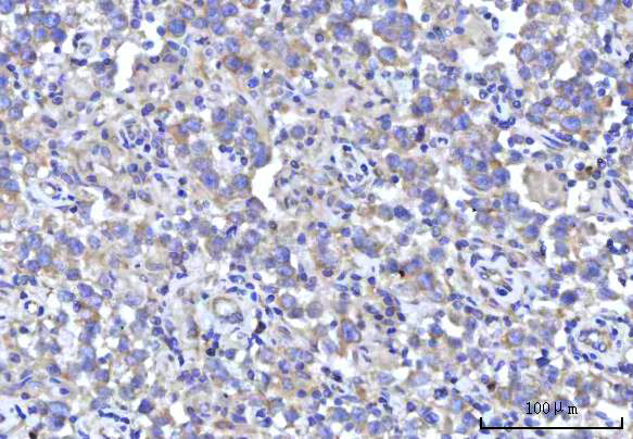 a04460 2 rps5 primary antibodies ihc testing 5