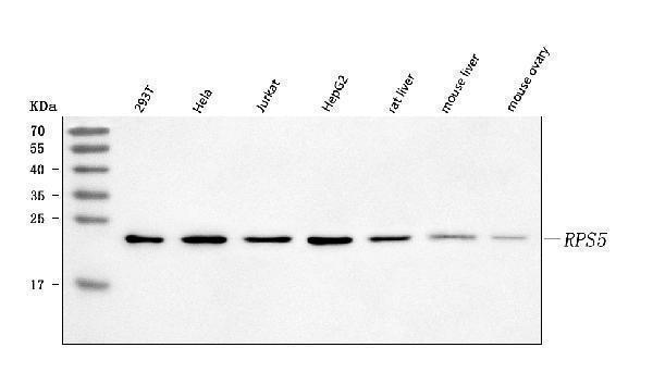  Western blot analysis of RPS5 using anti-RPS5 antibody (A04460-2)
