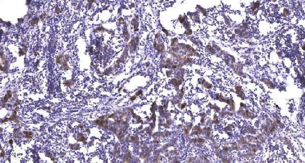 Immunohistochemical analysis of paraffin-embedded human Breast cancer