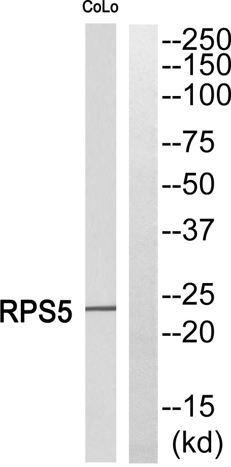 Western blot analysis of RPS5 Antibody