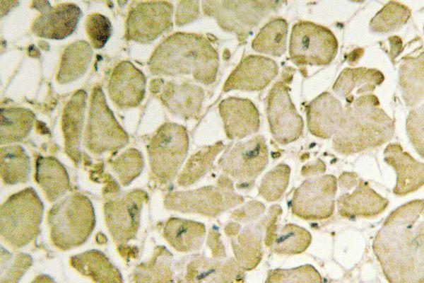 a04464 1 cyb5a primary antiboties ihc testing 2