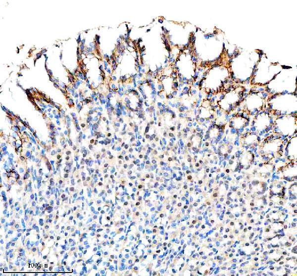  IHC analysis of SLC5A5 using anti-SLC5A5 antibody (A04465-1)