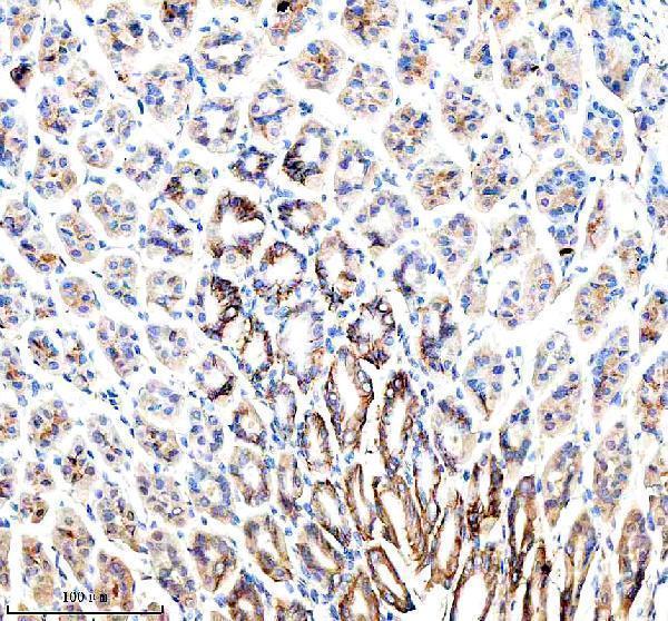  IHC analysis of SLC5A5 using anti-SLC5A5 antibody (A04465-1)