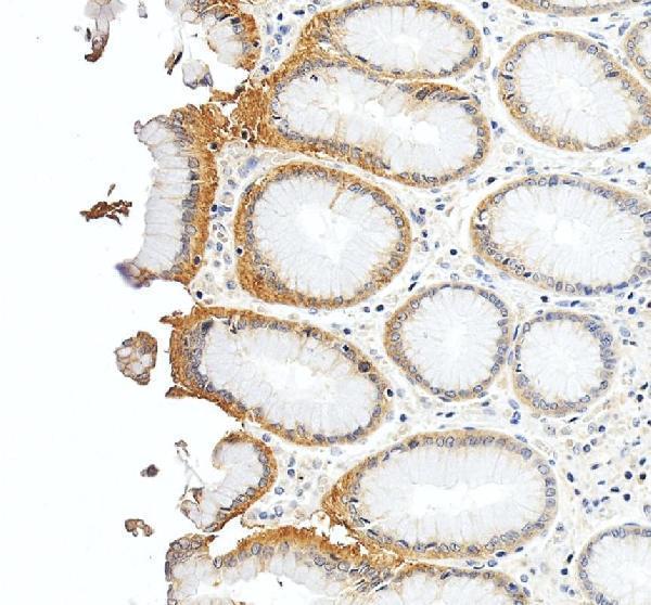 a04465 1 slc5a5 primary antibodies ihc testing 4