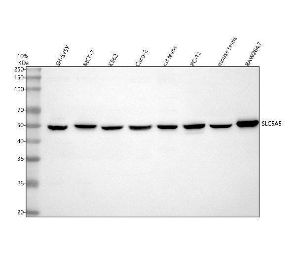  Western blot analysis of SLC5A5 using anti-SLC5A5 antibody (A04465-1)