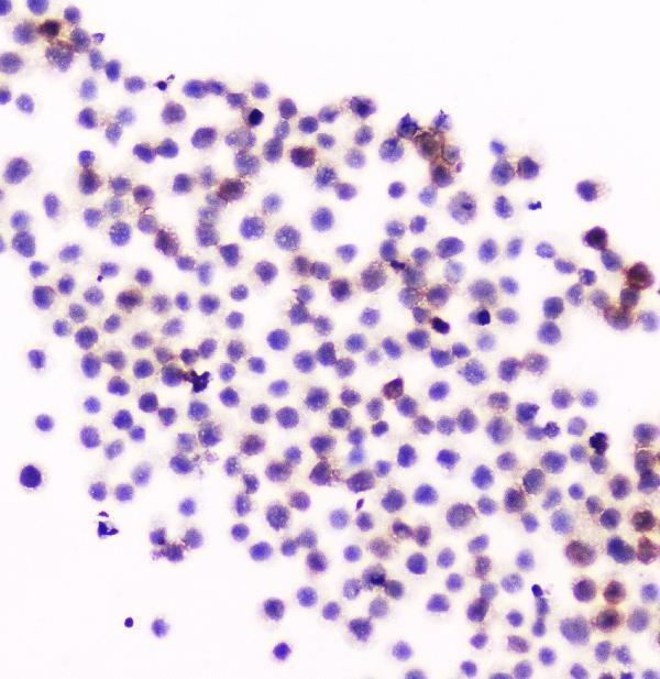 a04466 1 cd11a primary antibodies ihc testing 3