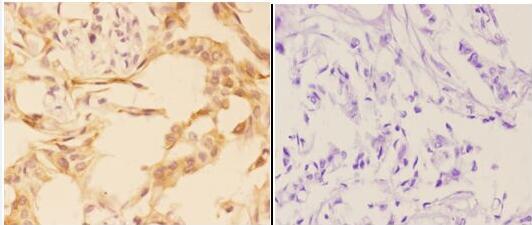 a04467 1 prkag1 primary antiboties ihc testing 2