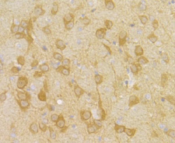 Immunohistochemical analysis of paraffin-embedded rat brain tissue using anti-PGAM1 antibody