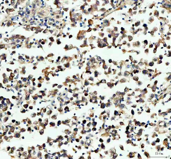 IHC analysis of PGAM1 using anti-PGAM1 antibody (A04470-2)