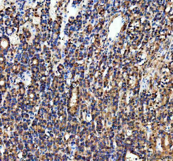 a04470 2 pgam1 primary antibodies ihc testing 2