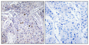Immunohistochemistry validation of MLLT10 using Anti-AF-10 MLLT10 Antibody (A04471-1)