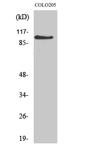 Western blotting validation for Anti-AF-10 MLLT10 Antibody A04471-1
Western Blot (WB) analysis of specific cells using AF-10 polyclonal antibody