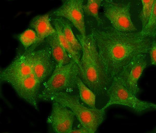 IF analysis of MLLT10 using anti-MLLT10 antibody (A04471-2) and anti-Beta Tubulin antibody (M01857-3)