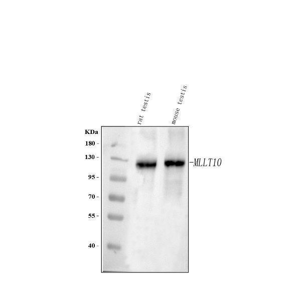  Western blot analysis of MLLT10 using anti-MLLT10 antibody (A04471-2)