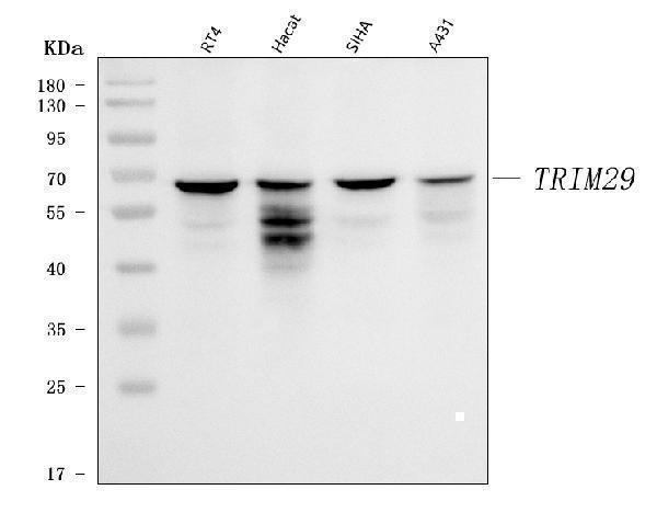  Western blot analysis of TRIM29 using anti-TRIM29 antibody (A04472-1)