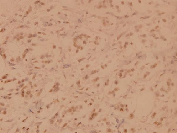 a04474y24 senp3 primary antiboties ihc testing 2